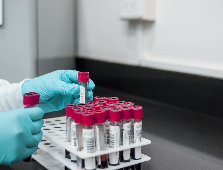 Local Laboratories authorized to test for COVID-19 Local Laboratories authorized to test for COVID-19